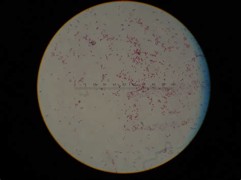e coli gram stain 100x.